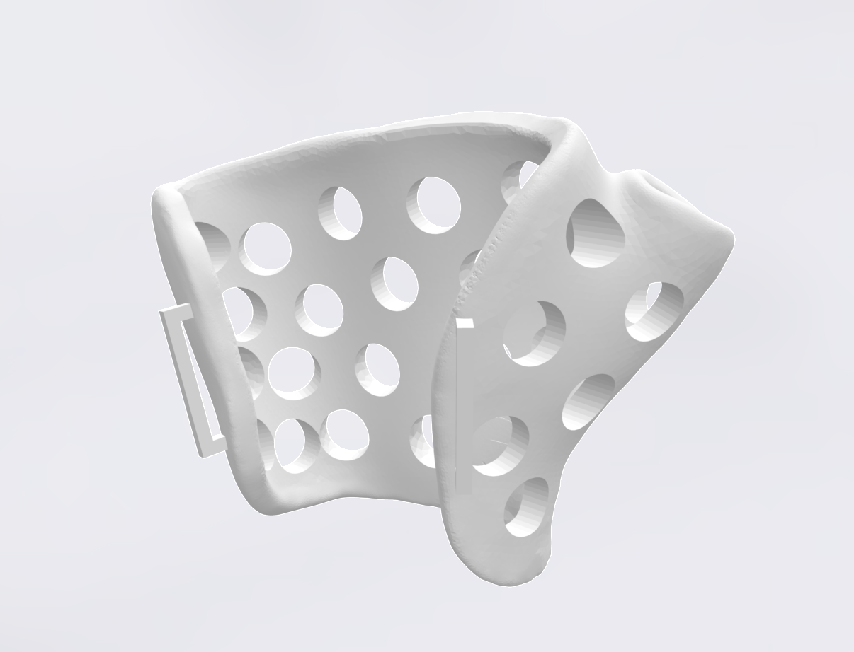 3D printed arm orthosis